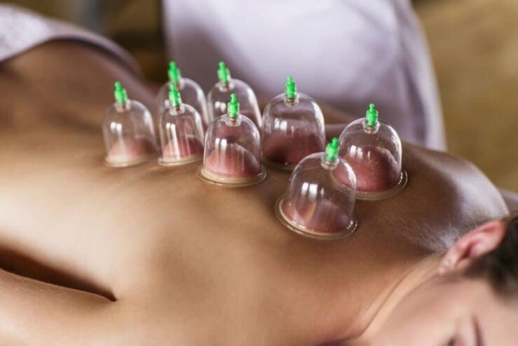 Al Wahab Hijama Cupping Clinic