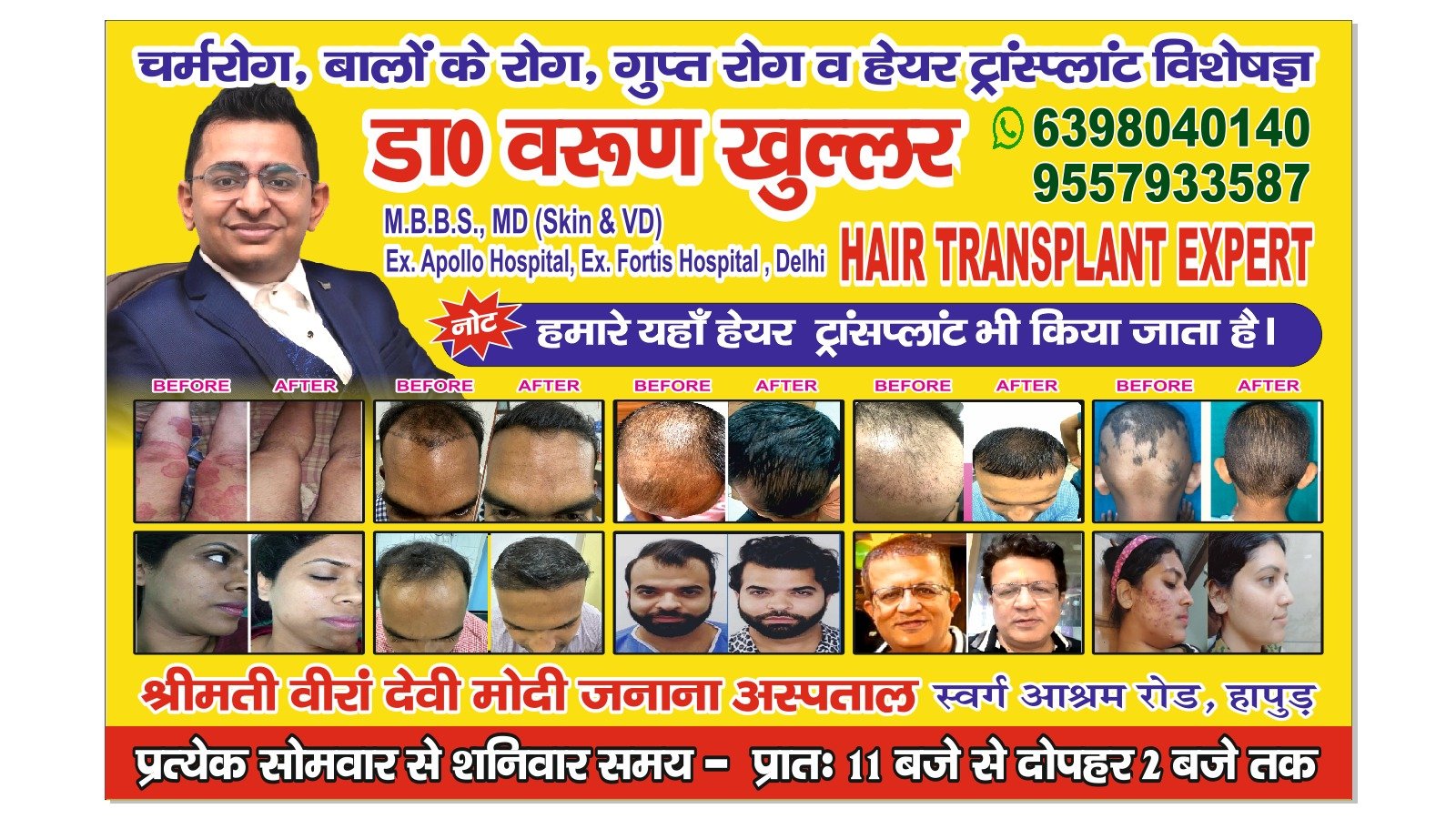 Dr. Khullars Skin Hair and Hair Transplant Clinic